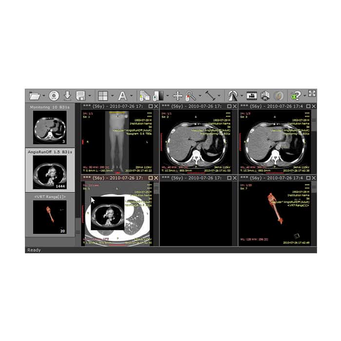 RadiAnt DICOM Viewer