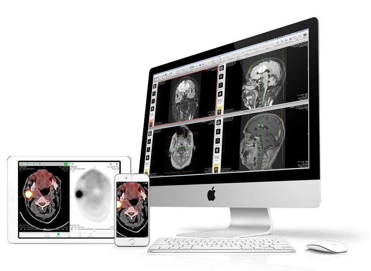 OsiriX DICOM Viewer